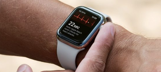 新的Apple Watch应该具有监视血糖的功能